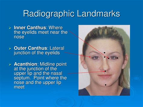 radiographic landmarks of the skull